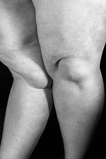 A black and white photograph of legs with very high contrast
